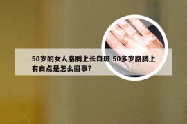 50岁的女人胳膊上长白斑 50多岁胳膊上有白点是怎么回事?