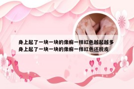 身上起了一块一块的像癣一样红色越起越多 身上起了一块一块的像癣一样红色还脱皮