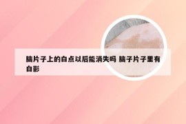 脑片子上的白点以后能消失吗 脑子片子里有白影