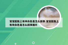 宝宝屁股上有块白色是怎么回事 宝宝屁股上有块白色是怎么回事图片