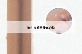治牛皮癣用什么穴位
