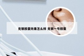 克银胶囊效果怎么样 克银一号胶囊