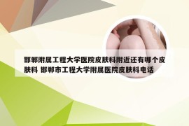 邯郸附属工程大学医院皮肤科附近还有哪个皮肤科 邯郸市工程大学附属医院皮肤科电话