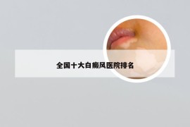 全国十大白癜风医院排名