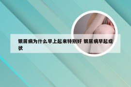 银屑病为什么早上起来特别好 银屑病早起症状