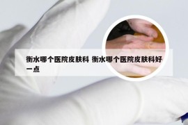 衡水哪个医院皮肤科 衡水哪个医院皮肤科好一点