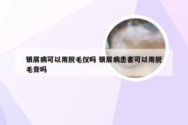 银屑病可以用脱毛仪吗 银屑病患者可以用脱毛膏吗