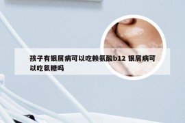 孩子有银屑病可以吃赖氨酸b12 银屑病可以吃氨糖吗