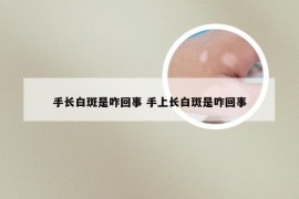 手长白斑是咋回事 手上长白斑是咋回事