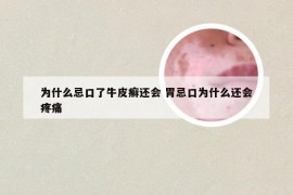 为什么忌口了牛皮癣还会 胃忌口为什么还会疼痛