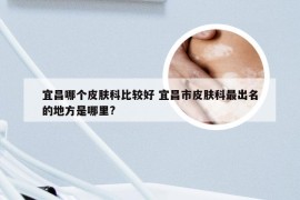 宜昌哪个皮肤科比较好 宜昌市皮肤科最出名的地方是哪里?