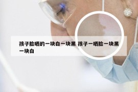 孩子脸晒的一块白一块黑 孩子一晒脸一块黑一块白