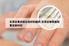 石家庄看皮肤比较好的医院 石家庄哪家医院看皮肤科好