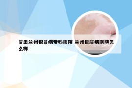 甘肃兰州银屑病专科医院 兰州银屑病医院怎么样