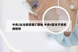中央2台治银屑病禤国维 中央4套关于银屑病视频