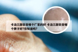 卡泊三醇软膏哪个厂家的好 卡泊三醇软膏哪个牌子好?你知道吗?