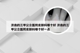 济南的三甲公立医院皮肤科哪个好 济南的三甲公立医院皮肤科哪个好一点