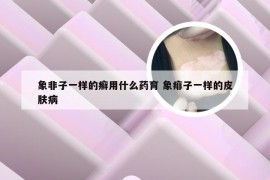 象非子一样的癣用什么药育 象痱子一样的皮肤病