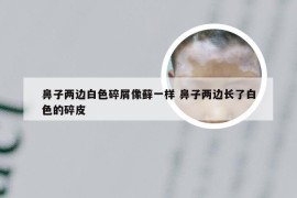 鼻子两边白色碎屑像藓一样 鼻子两边长了白色的碎皮