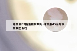 维生素D2能治银屑病吗 维生素d3治疗银屑病怎么吃