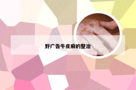 野广告牛皮癣的整治
