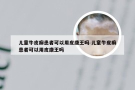 儿童牛皮癣患者可以用皮康王吗 儿童牛皮癣患者可以用皮康王吗