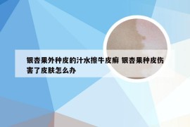 银杏果外种皮的汁水擦牛皮癣 银杏果种皮伤害了皮肤怎么办