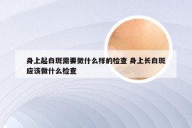 身上起白斑需要做什么样的检查 身上长白斑应该做什么检查