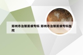 郑州市治银屑病专科 郑州市治银屑病专科医院