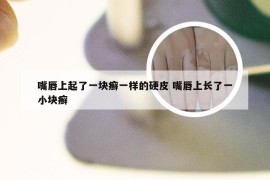 嘴唇上起了一块癣一样的硬皮 嘴唇上长了一小块癣