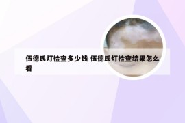 伍德氏灯检查多少钱 伍德氏灯检查结果怎么看