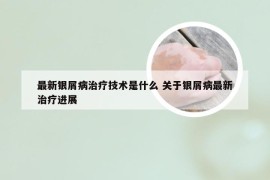 最新银屑病治疗技术是什么 关于银屑病最新治疗进展