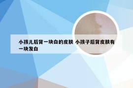 小孩儿后背一块白的皮肤 小孩子后背皮肤有一块发白