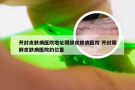 开封皮肤病医院地址朝鲜皮肤病医院 开封朝鲜皮肤病医院的位置