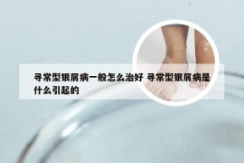 寻常型银屑病一般怎么治好 寻常型银屑病是什么引起的