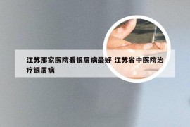 江苏那家医院看银屑病最好 江苏省中医院治疗银屑病