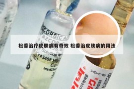 松香治疗皮肤病有奇效 松香治皮肤病的用法