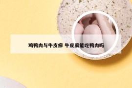 鸡鸭肉与牛皮癣 牛皮廨能吃鸭肉吗