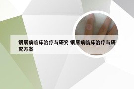 银屑病临床治疗与研究 银屑病临床治疗与研究方案