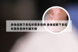 身体皮肤下多处长很多包块 身体皮肤下多处长很多包块不痛不痒