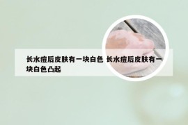 长水痘后皮肤有一块白色 长水痘后皮肤有一块白色凸起