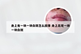 身上有一块一块白斑怎么回事 身上出现一块一块白斑