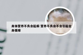 身体营养不良会起癣 营养不良会不会引起全身瘙痒