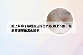 脸上长癣干燥脱皮还痒怎么办 脸上长癣干燥脱皮还痒是怎么回事