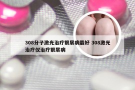 308分子激光治疗银屑病最好 308激光治疗仪治疗银屑病