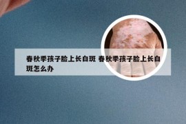 春秋季孩子脸上长白斑 春秋季孩子脸上长白斑怎么办