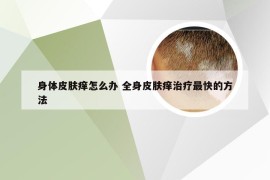 身体皮肤痒怎么办 全身皮肤痒治疗最快的方法