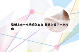 胳膊上有一小块癣怎么办 胳膊上长了一小片癣