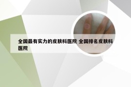 全国最有实力的皮肤科医院 全国排名皮肤科医院