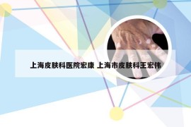 上海皮肤科医院宏康 上海市皮肤科王宏伟